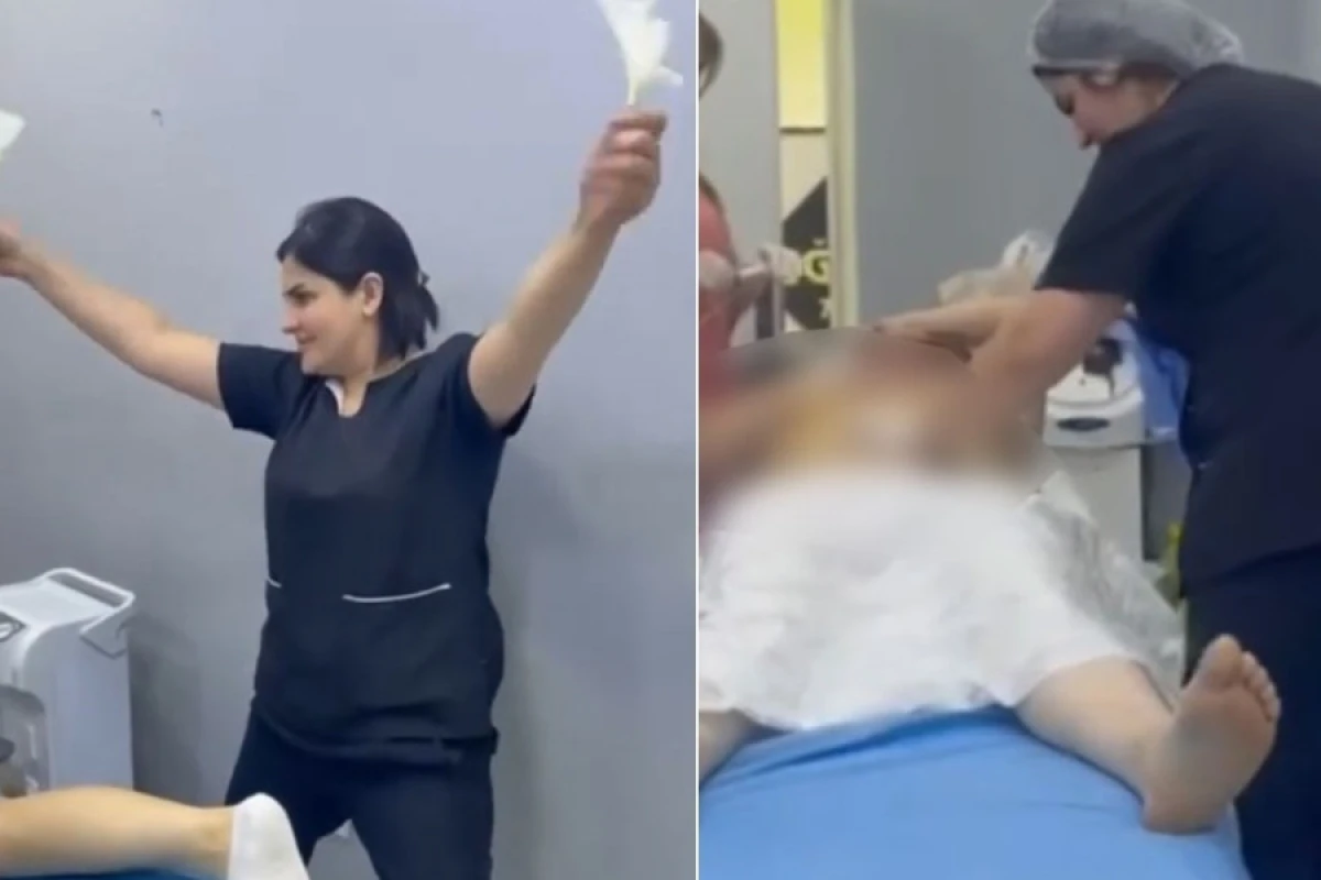 Sosial şəbəkədə estetik əməliyyatla bağlı yayılan görüntülərə aydınlıq gətirildi