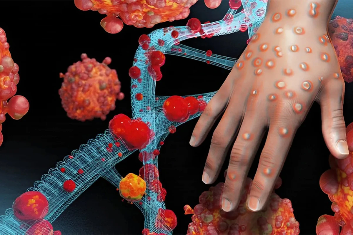 Nigeriyada vəba epidemiyası: Ölənlər var