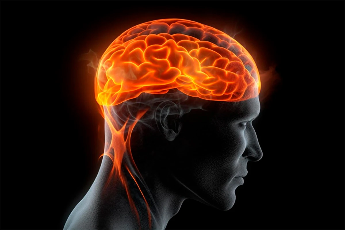AI epilepsiyalı uşaqlarda gizli beyin zədələrini aşkarladı