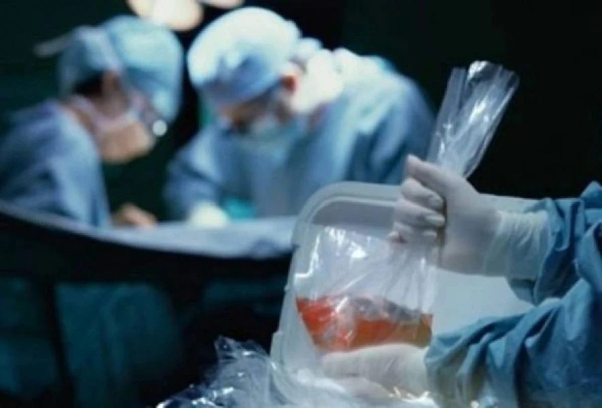 Azərbaycanda 2025-ci ilin 10 ayında 160-a yaxın orqan transplantasiyası həyata keçirildi