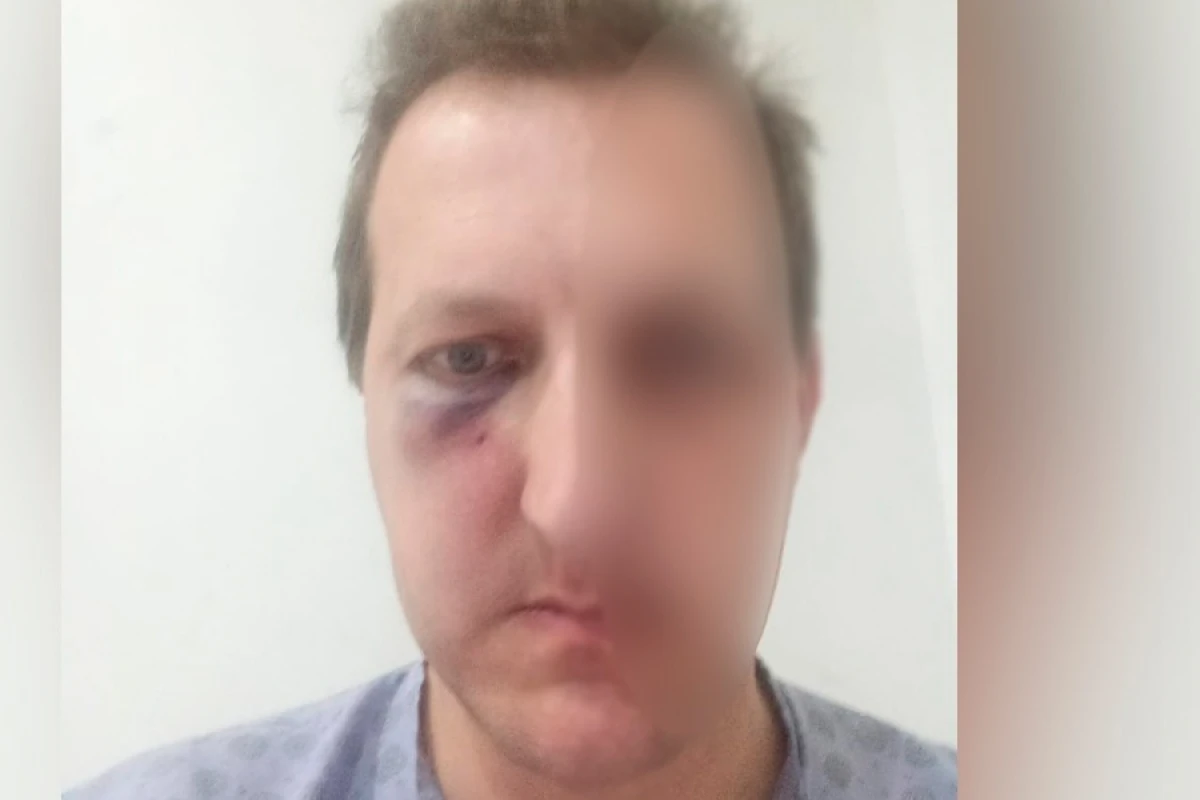 Xalq artistinin döyülən oğlunun SON DURUMU açıqlandı