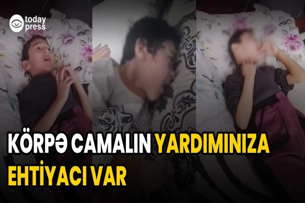 Bir iynənin qiyməti 1200 manatdır… - Camala yardım edək – VİDEO